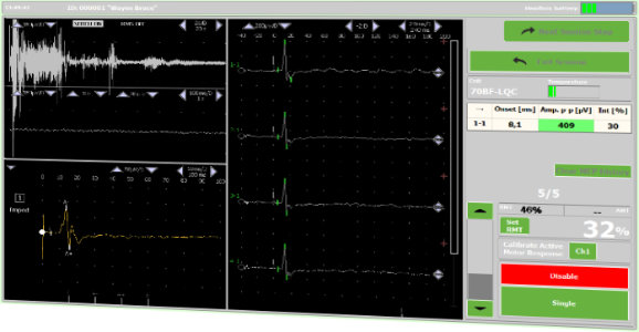 DuoMAG rTMS Software